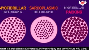 What Is Sarcoplasmic & Myofibrillar Hypertrophy