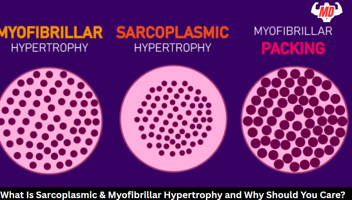 What Is Sarcoplasmic & Myofibrillar Hypertrophy
